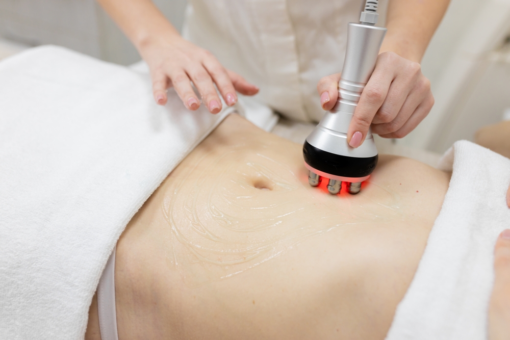 Ultrasonic cavitation treatment on abdomen, technician using machine to target stubborn fat, non-invasive body sculpting at Superior Sculpting.